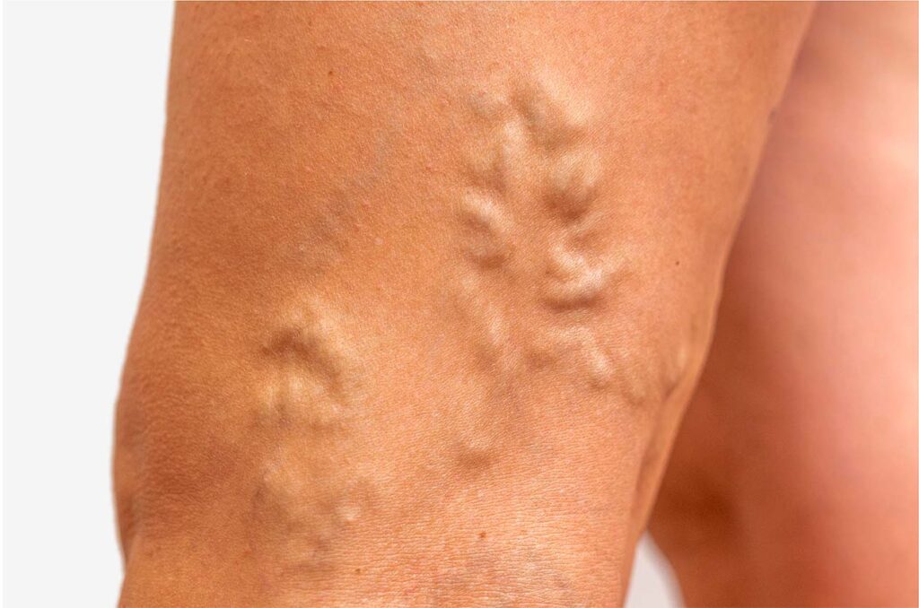 DR. Felipe Ribeiro - Cirurgião vascular